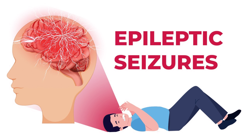 Holistic epilepsy healing using Ayurveda, sound therapy, counseling, and integrative neurological care